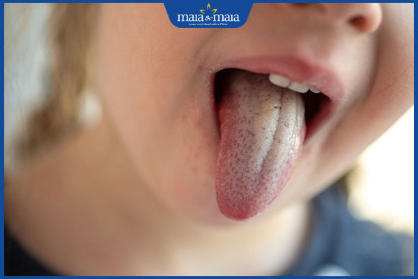 trẻ 3 tuổi nấm miệng