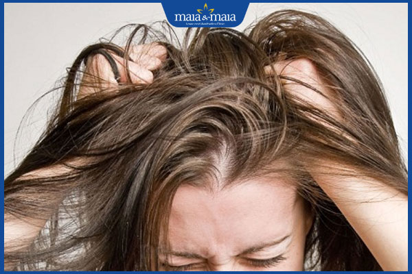 Nấm da đầu ở trẻ em: Triệu chứng nhận biết và cách điều trị 3 trẻ ngứa ngáy dữ dội