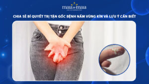 trị tận gốc bệnh nấm vùng kín