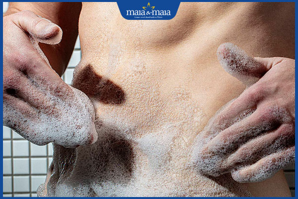 Nấm dương vật do đâu gây ra? Cách điều trị và phòng ngừa 7 vệ sinh vùng kín