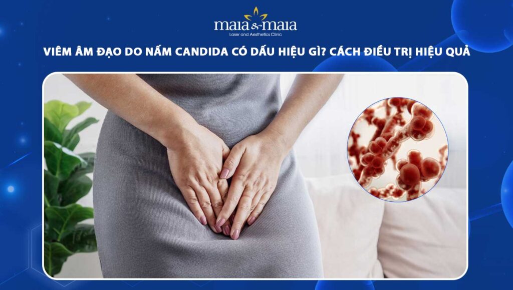 Viêm âm đạo do nấm Candida có dấu hiệu gì? Cách điều trị 1 viêm âm đạo do nấm candida