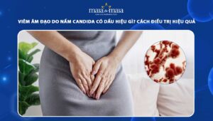 viêm âm đạo do nấm candida
