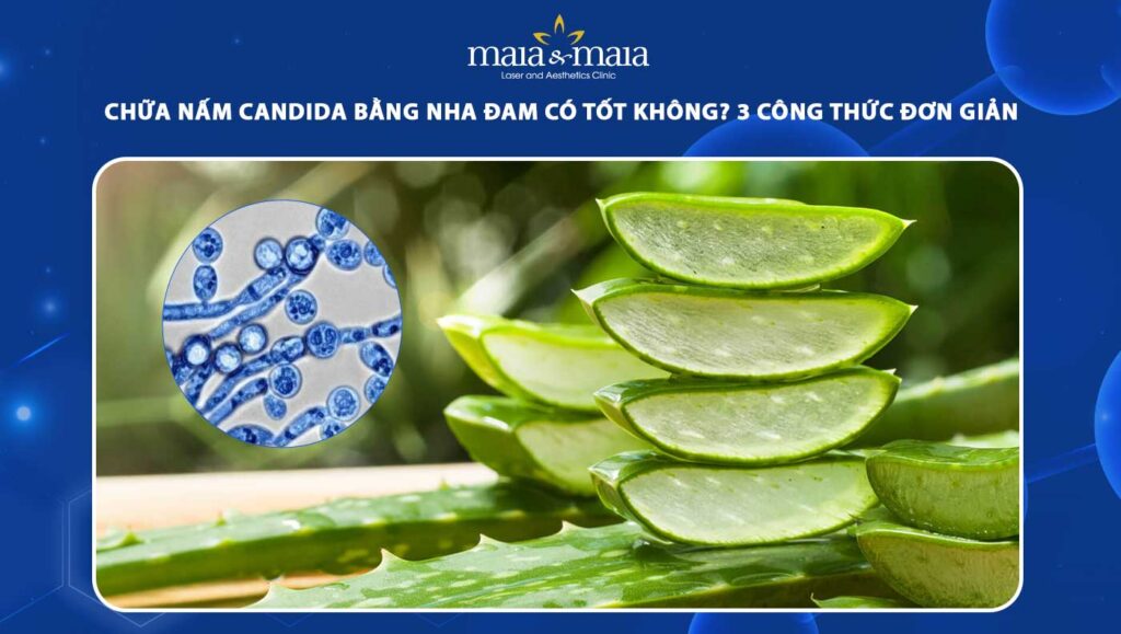 Chữa nấm Candida bằng nha đam có tốt không? Gợi ý thực hiện 1 chữa nấm candida bằng nha đam