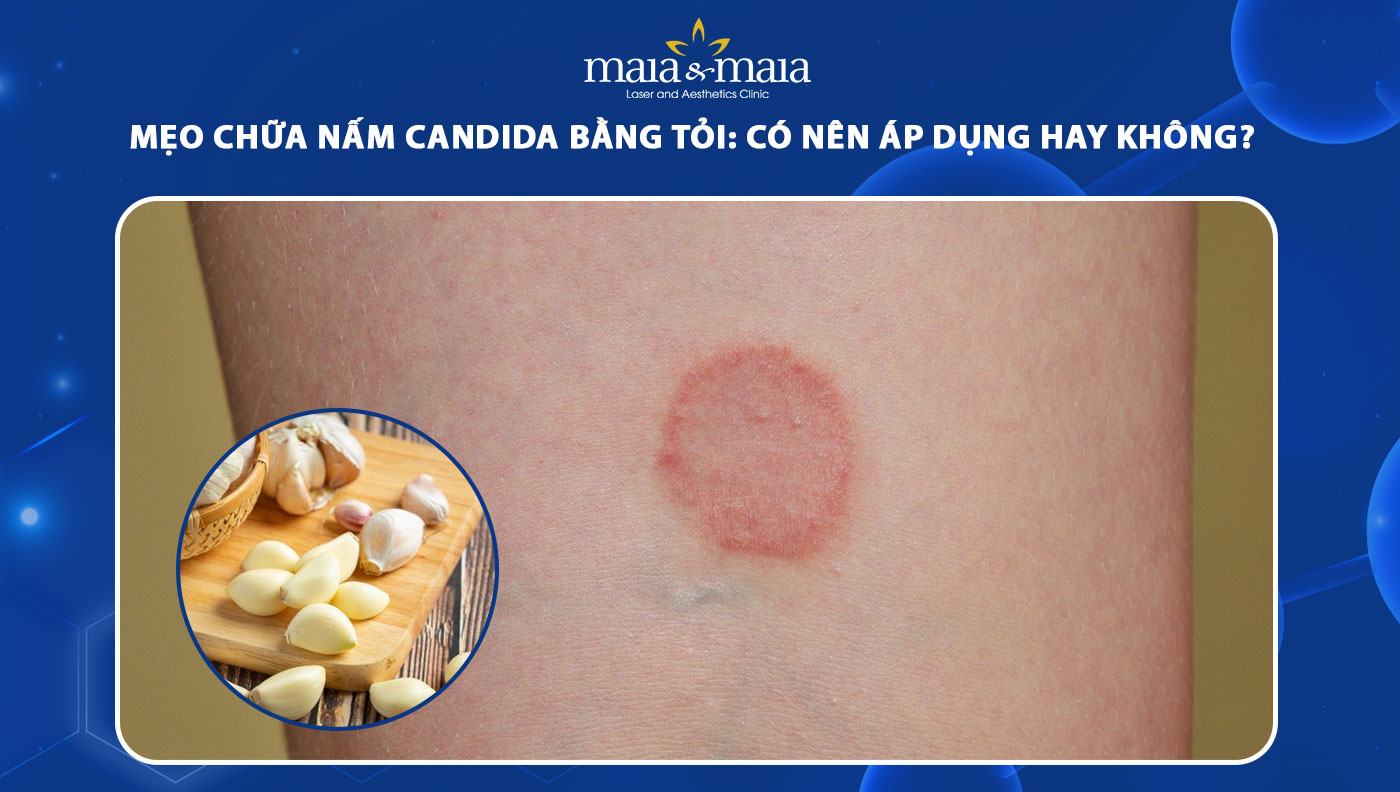 chữa nấm candida bằng tỏi