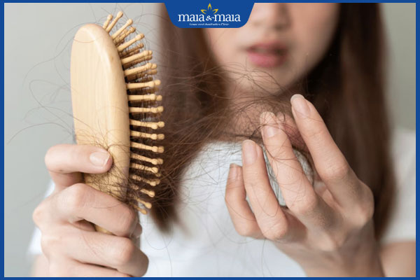 đặc điểm rụng tóc do lực kéo