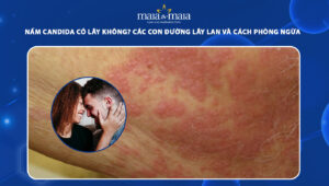 nấm candida có lây không