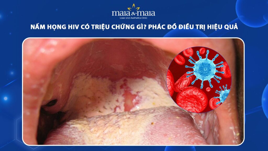 nấm họng hiv