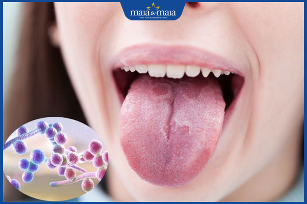 nhiễm nấm men candida xâm lấn