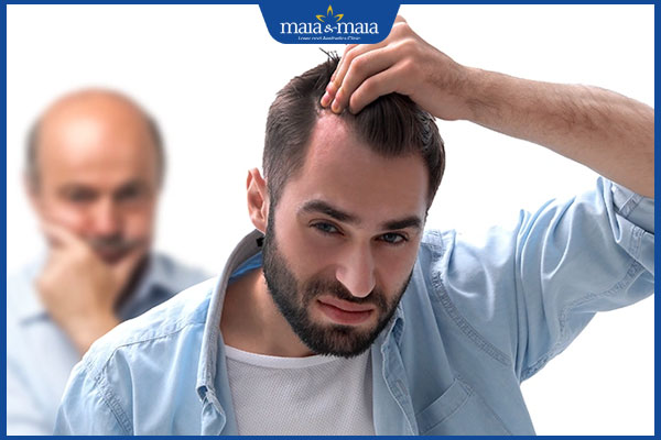 rụng tóc theo di truyền