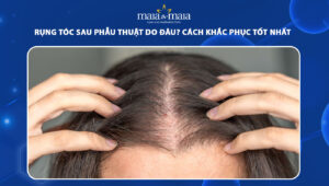 rụng tóc sau phẫu thuật