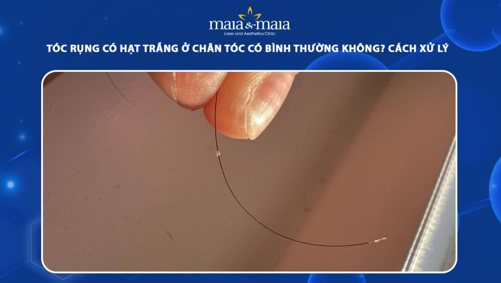 Tóc rụng có hạt trắng ở chân tóc có bình thường không? 1 tóc rụng có hạt trắng ở chân tóc