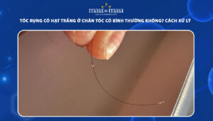 tóc rụng có hạt trắng ở chân tóc