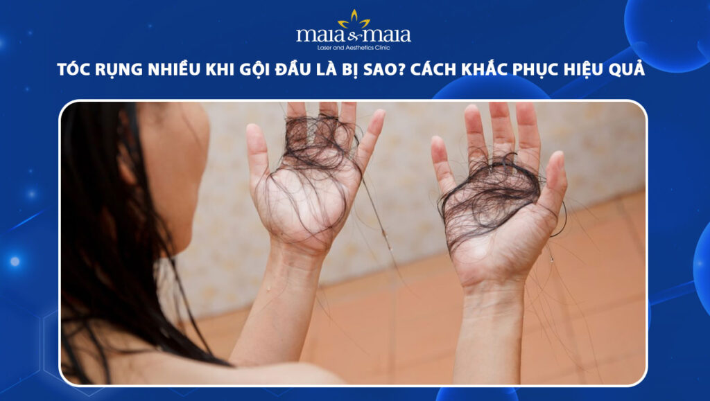 Tóc rụng nhiều khi gội đầu là bị sao? Cách khắc phục đúng 1 tóc rụng nhiều khi gội đầu