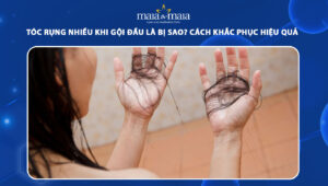 tóc rụng nhiều khi gội đầu