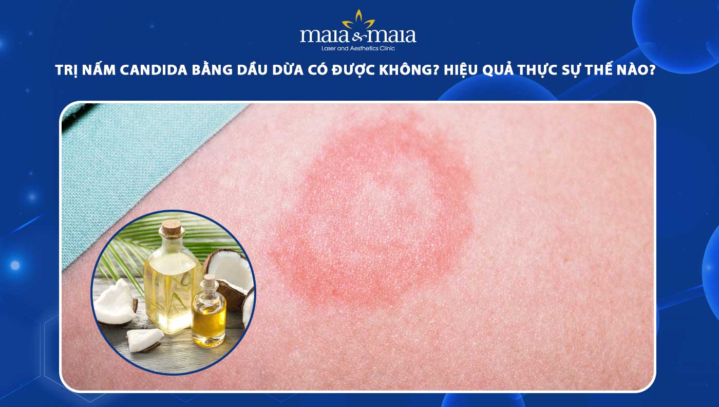 trị nấm candida bằng dầu dừa