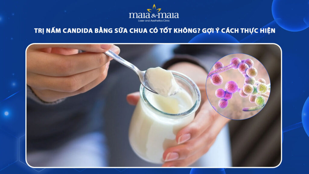 Trị nấm Candida bằng sữa chua có tốt không? Gợi ý thực hiện 1 trị nấm candida bằng sữa chua