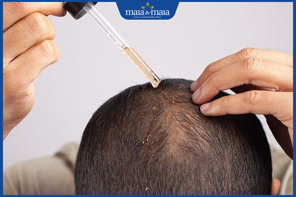 bôi thuốc trị rụng tóc