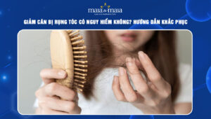 giảm cân bị rụng tóc