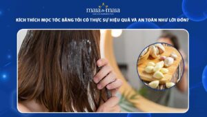 kích thích mọc tóc bằng tỏi