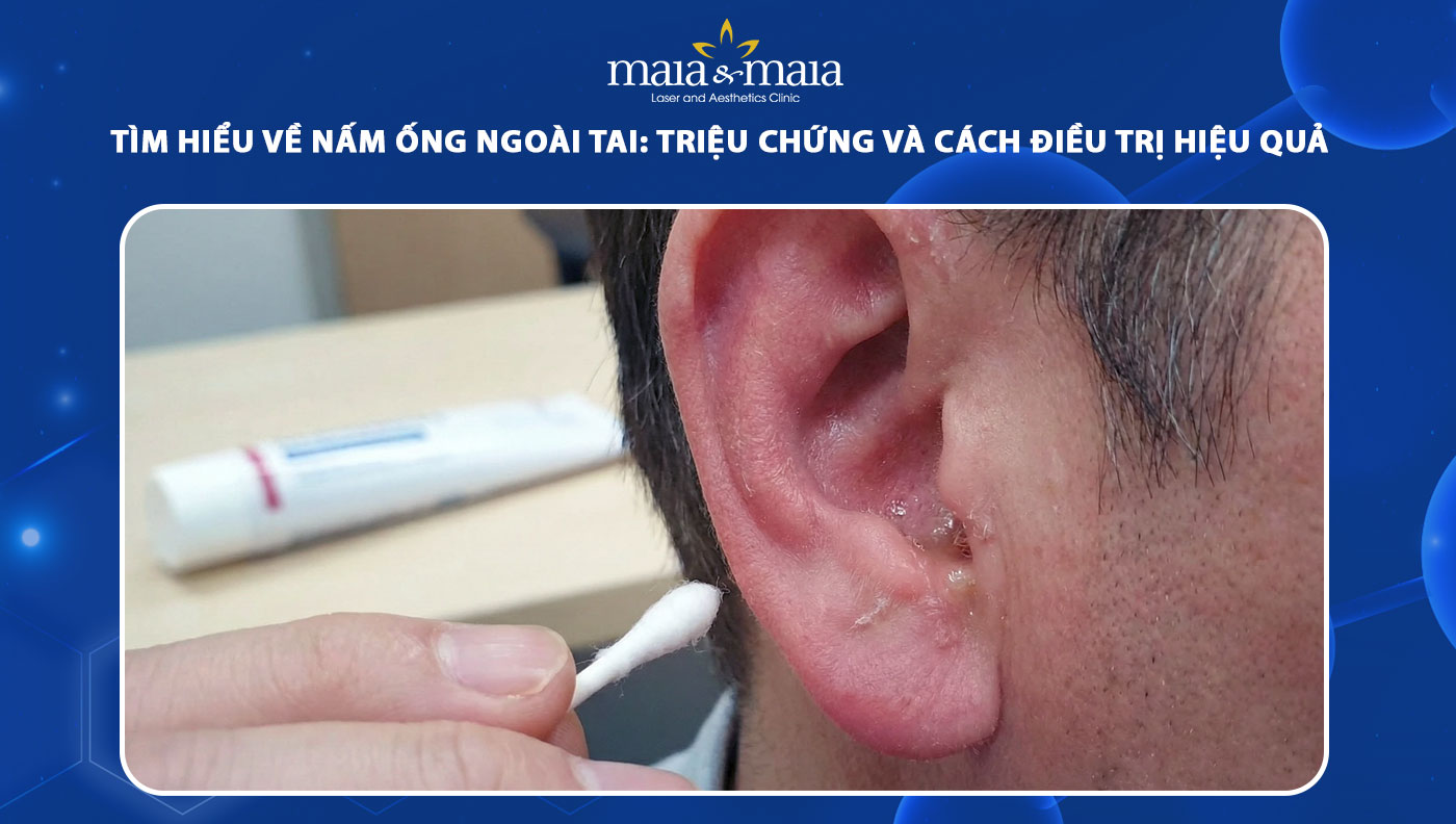nấm ống ngoài tai