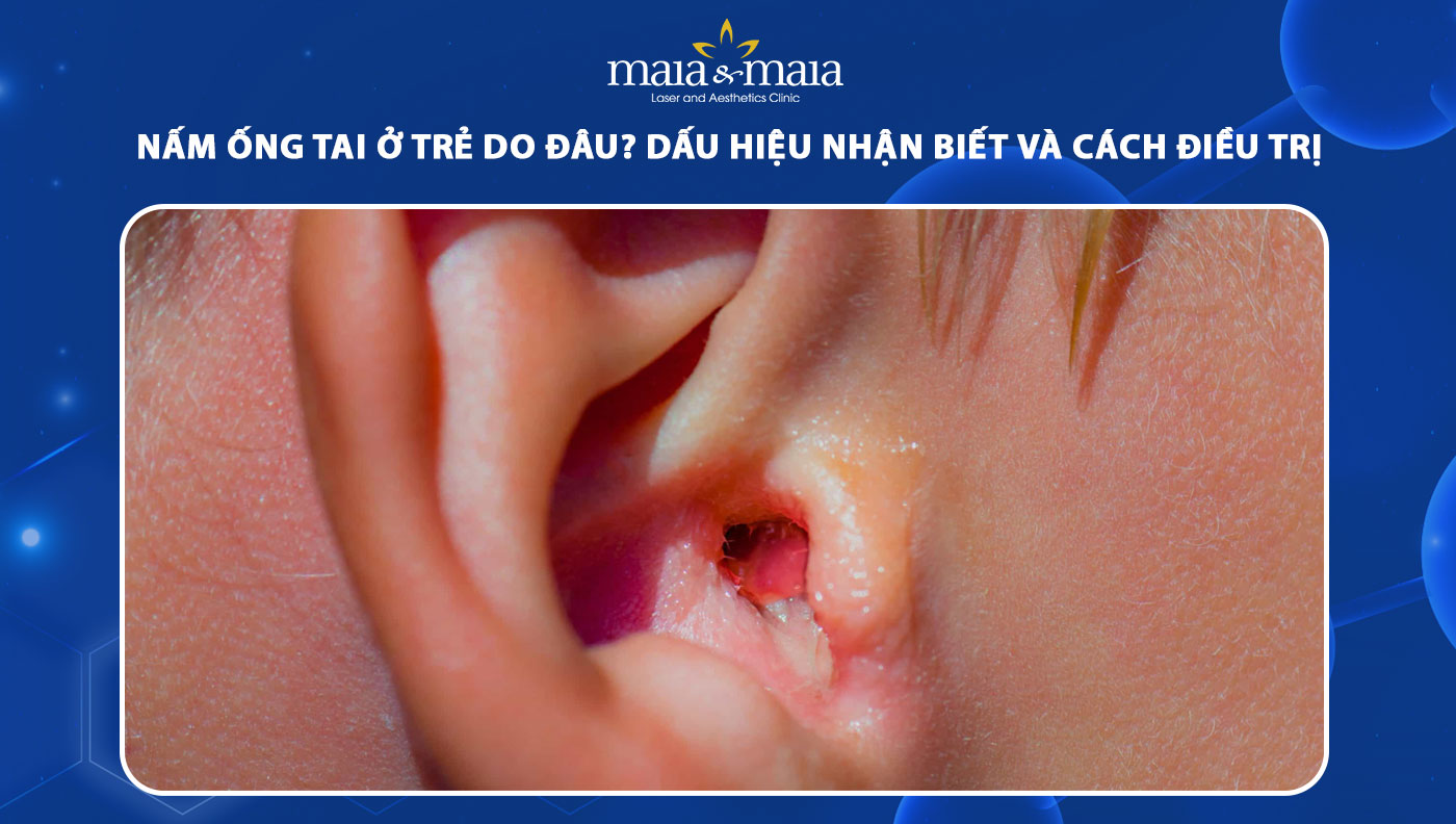 nấm ống tai ở trẻ