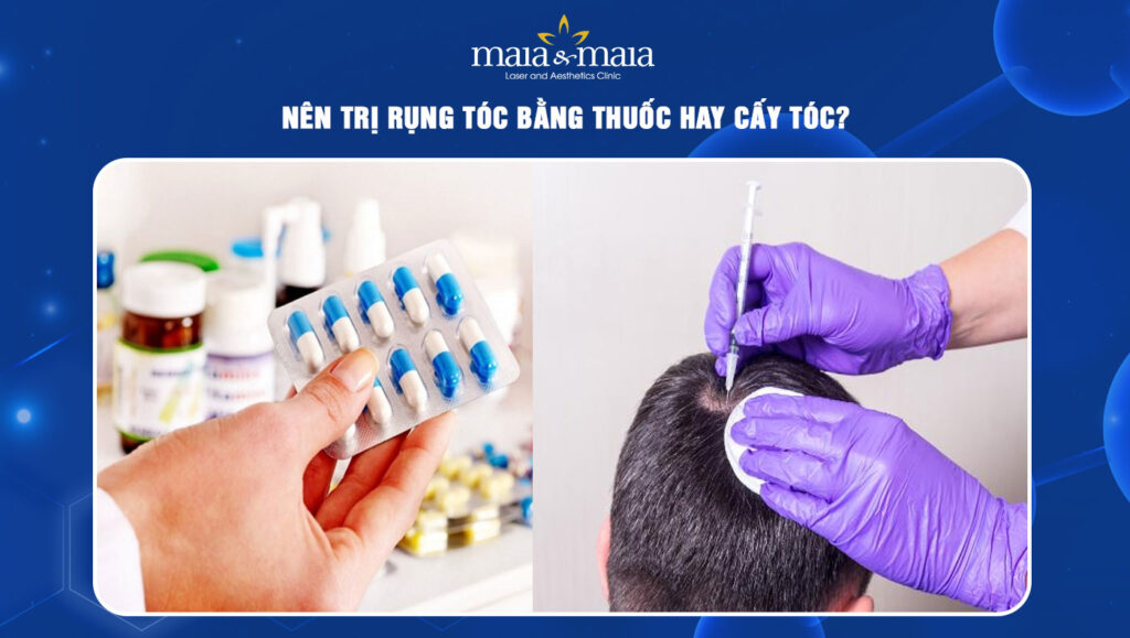 nên trị rụng tóc bằng thuốc hay cấy tóc