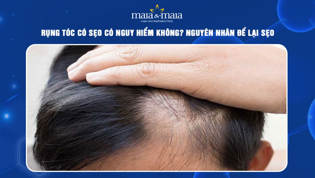 rụng tóc có sẹo