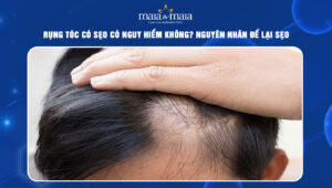 rụng tóc có sẹo