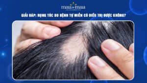 rụng tóc do bệnh tự miễn