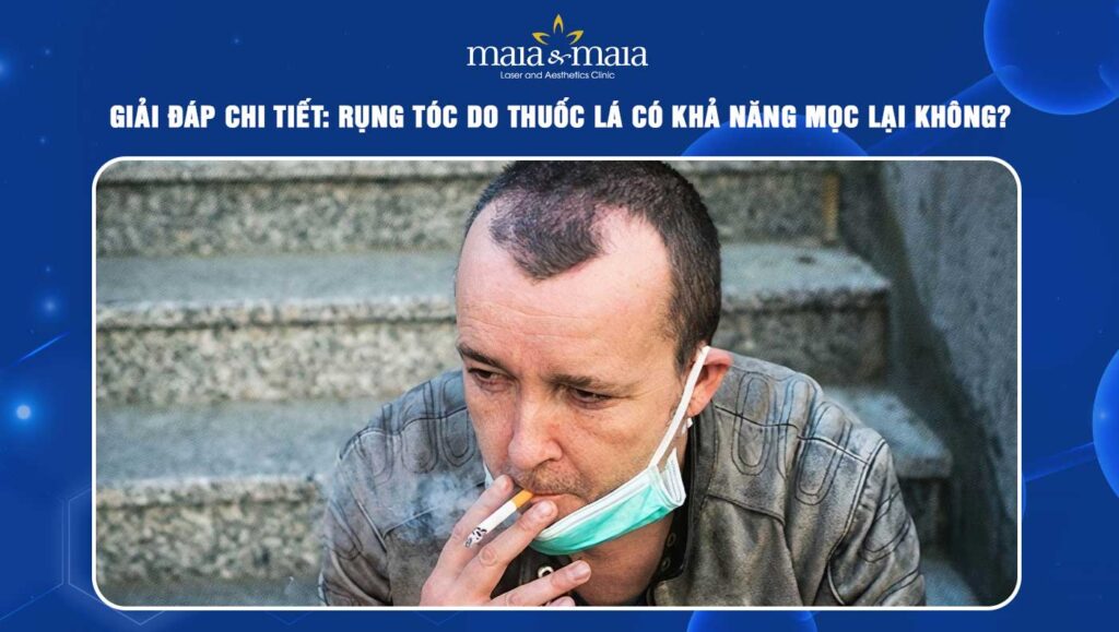 Giải đáp chi tiết: Rụng tóc do thuốc lá có khả năng mọc lại không? 1 rụng tóc do thuốc lá
