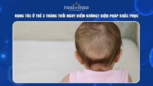 rụng tóc ở trẻ 3 tháng tuổi
