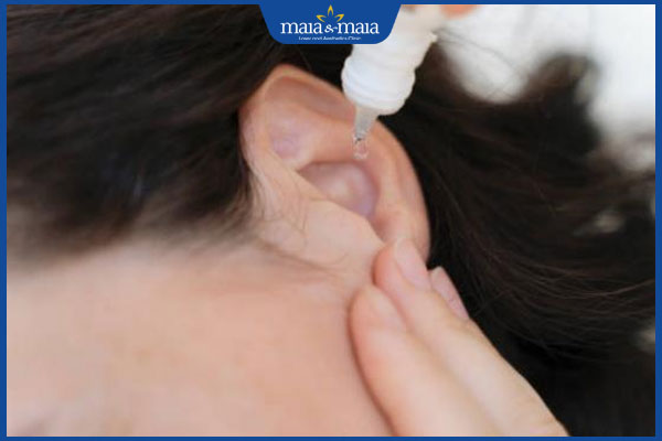 Thuốc trị nấm ống tai được bác sĩ tin dùng và lưu ý cần biết 3 thuốc nhỏ trị nấm tai