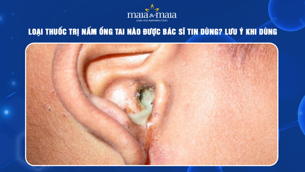 Thuốc trị nấm ống tai được bác sĩ tin dùng và lưu ý cần biết 1 thuốc trị nấm ống tai