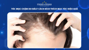 tóc mọc chậm