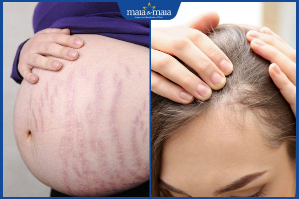 tóc và da đầu khi mang thai