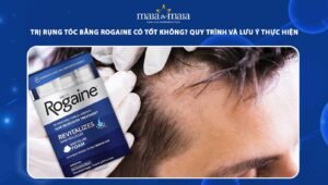 trị rụng tóc bằng rogaine