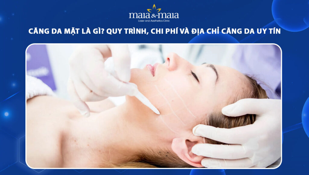 Quy trình, chi phí và địa chỉ thực hiện căng da mặt uy tín 1 căng da mặt