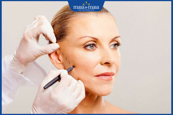 căng da mặt bán phần