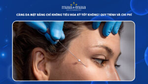 căng da mặt bằng chỉ không tiêu Hoa Kỳ