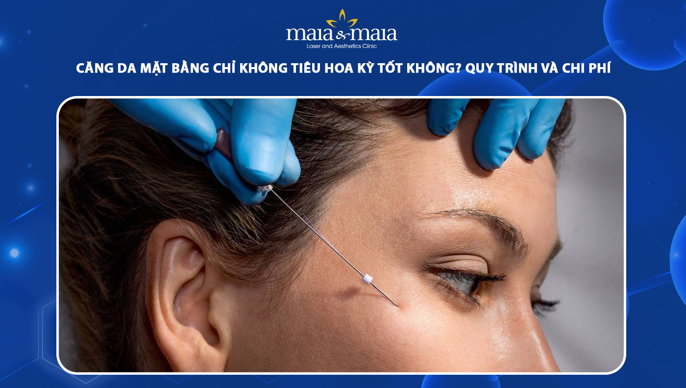 căng da mặt bằng chỉ không tiêu Hoa Kỳ