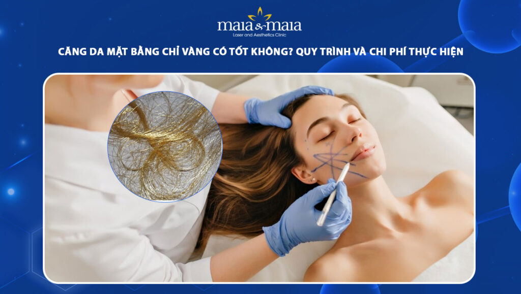 căng da mặt bằng chỉ vàng