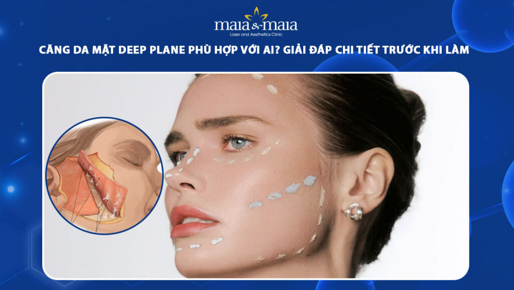 căng da mặt deep plane