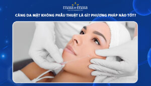 căng da mặt không phẫu thuật