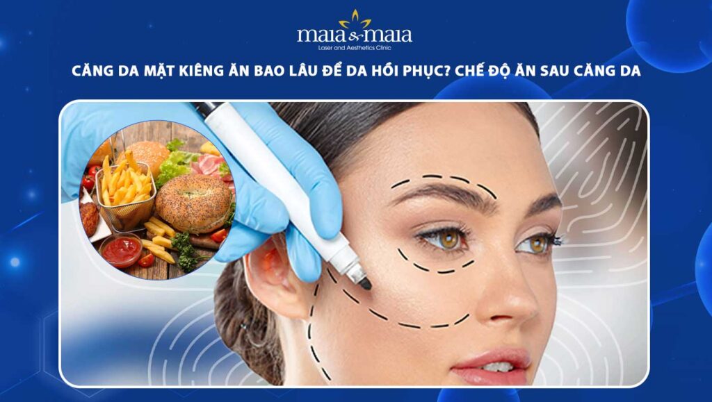 căng da mặt kiêng ăn bao lâu