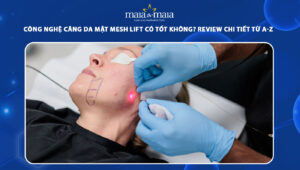 căng da mặt mesh lift