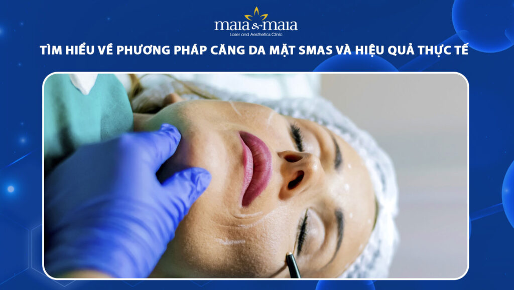 Tìm hiểu về phương pháp căng da mặt SMAS và hiệu quả thực tế 1 căng da mặt smas