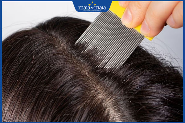 Rận mu có sống trên tóc không? Nhận biết nhanh trong 1 phút 3 chải chấy