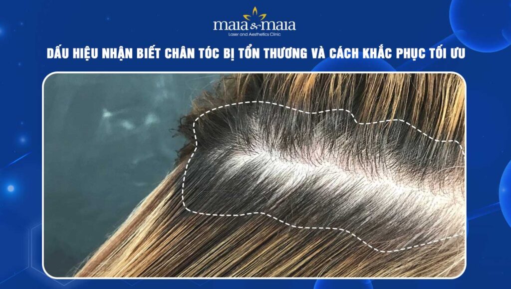 chân tóc