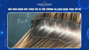 chân tóc