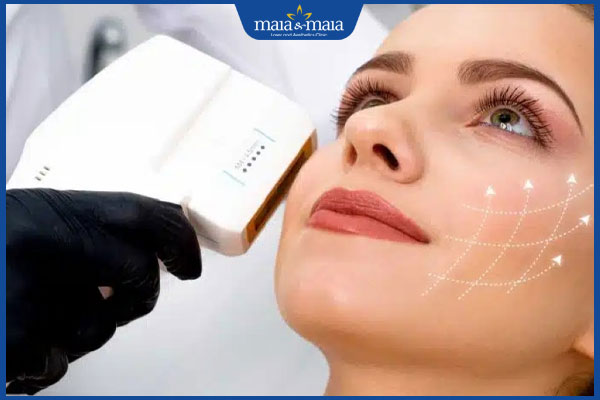 Căng da mặt 3D hiệu quả không? Quy trình & chi phí thực hiện 2 công nghệ căng da 3D